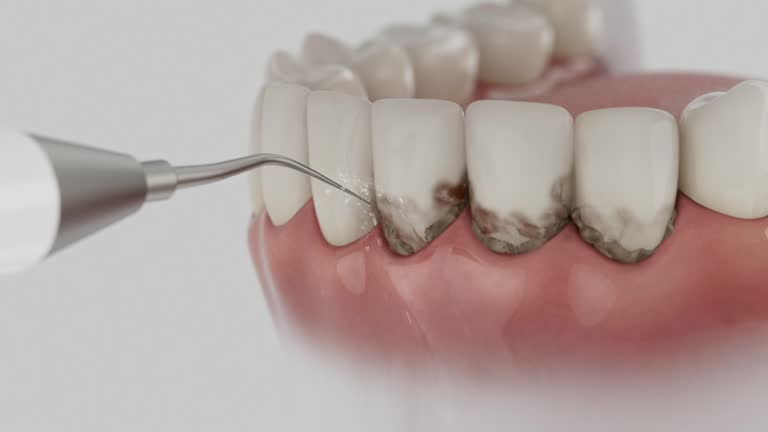 Reliable Teeth Cleaning And Checkup contractor in Van Buren County County, MI by Dentist Open Now